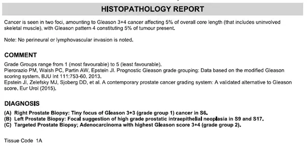 Parkway Laboratories Histopathology Report Sample.